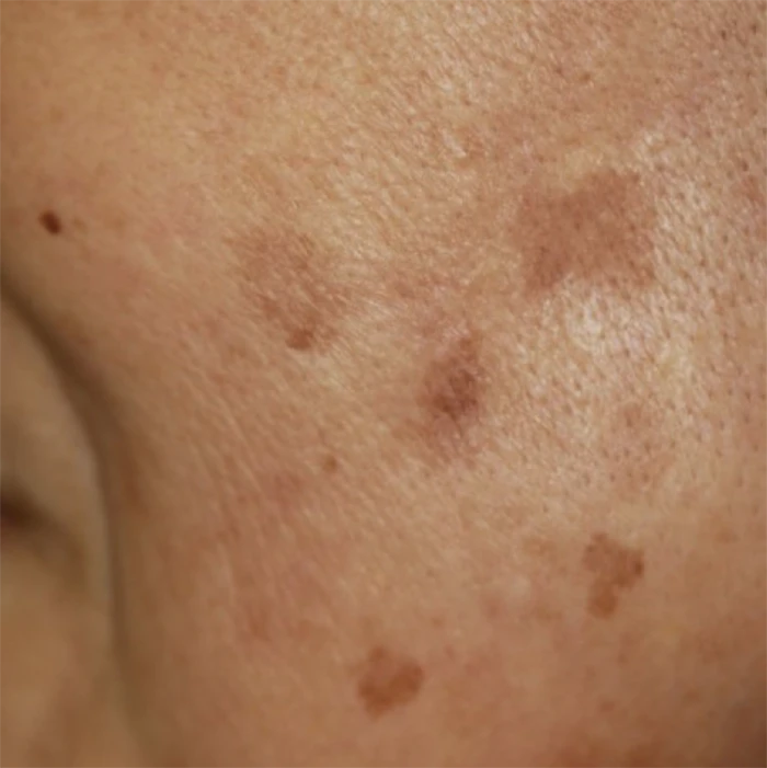 なのはな耳鼻咽喉科　Before