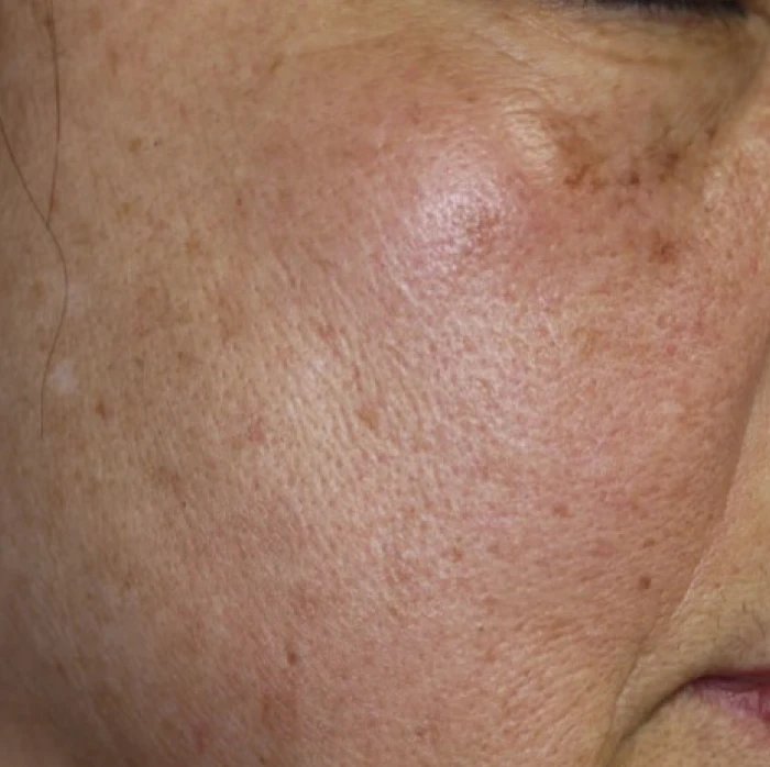 なのはな耳鼻咽喉科　Before