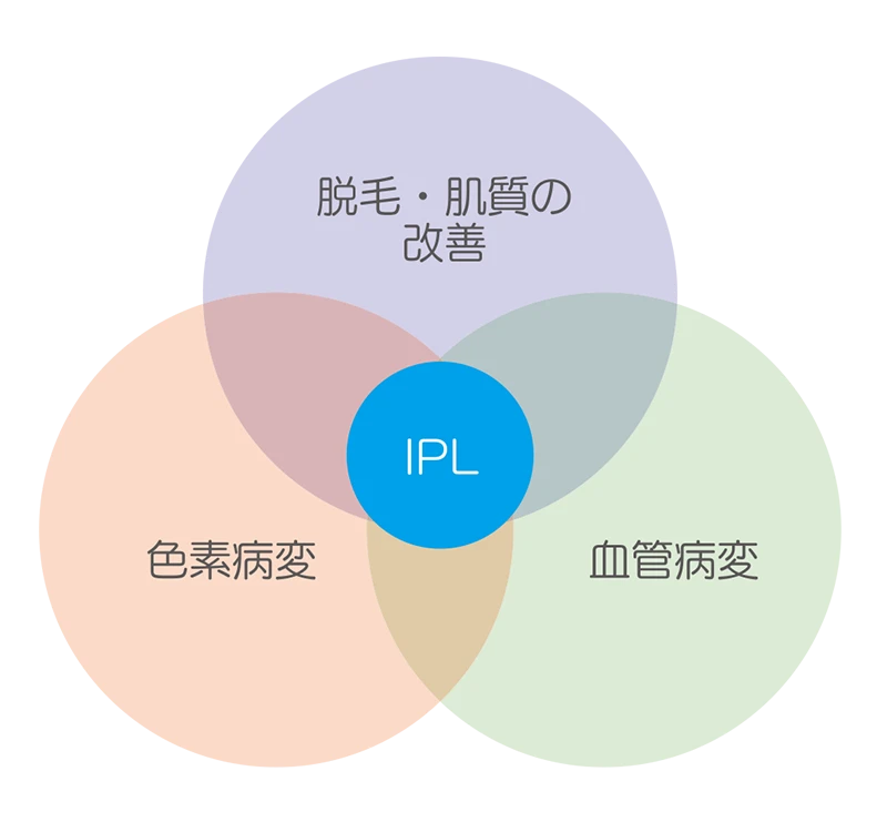 なのはな耳鼻咽喉科　IPLを表現したイラスト