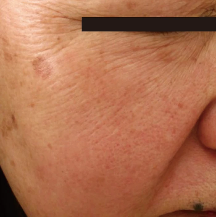 なのはな耳鼻咽喉科　Before