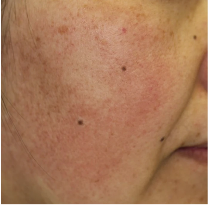 なのはな耳鼻咽喉科　Before