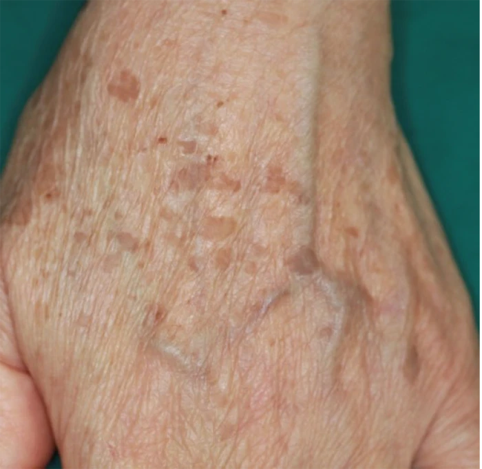 なのはな耳鼻咽喉科　Before