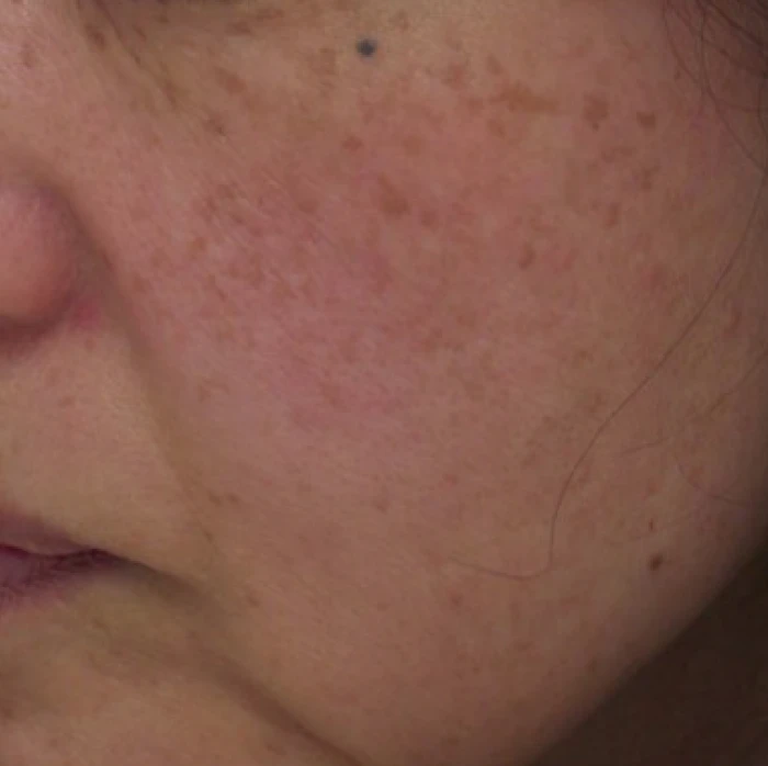 なのはな耳鼻咽喉科　Before